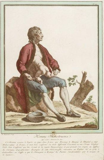 Illustration for article titled Beautiful Portraits of "Monstrosities" from the 18th Century